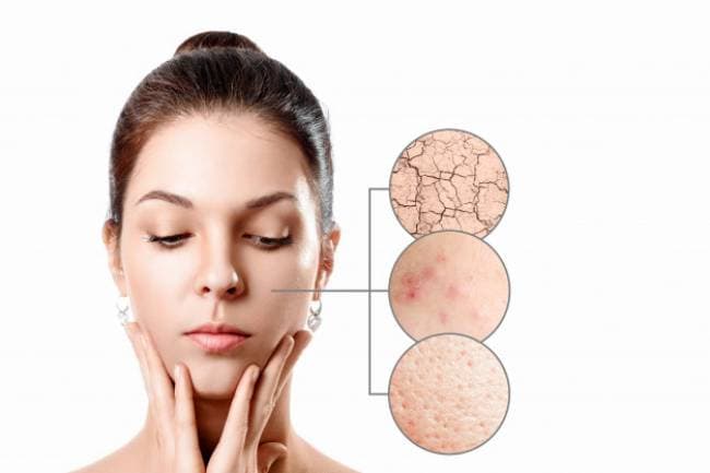 Tìm hiểu da mặt đang thuộc loại nào để có thể dễ dang chăm sóc hơn 
