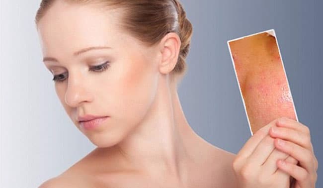 Các thành phần trong các loại bột khoáng thường cung cấp các đặc tính chống viêm giúp hỗ trợ những làn da có vấn đề