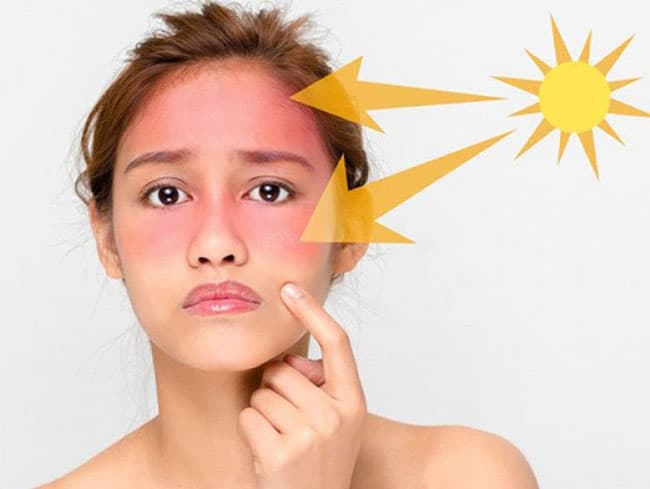 Kem chống nắng có chỉ số SPF 30 có khả năng ngăn chặn 97% tia UVB xâm nhập vào da của bạn