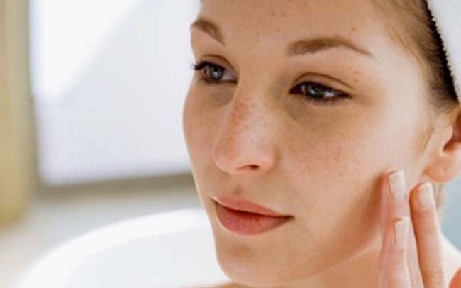 Da mặt là nơi bị ảnh hưởng từ nám da nặng nề nhất.