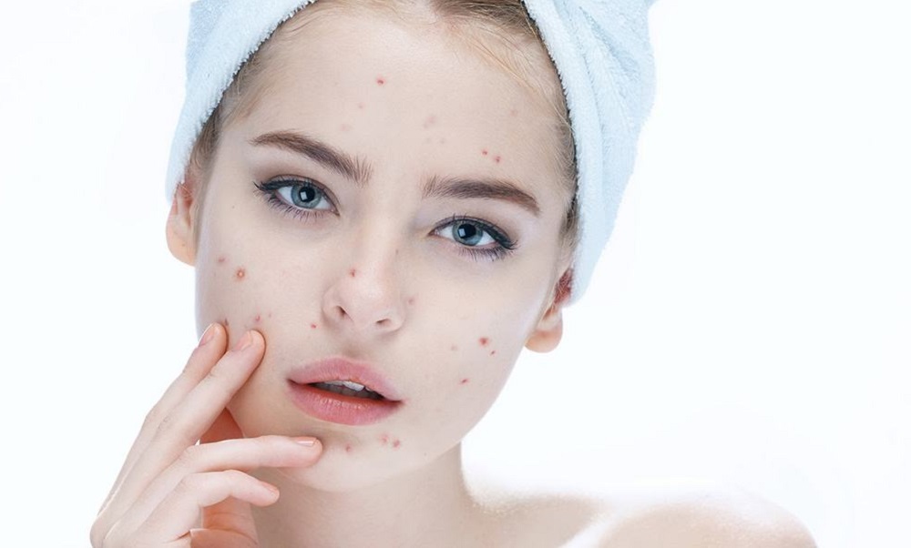Sử dụng serum có thể điều trị triệt để các vấn đề về mụn