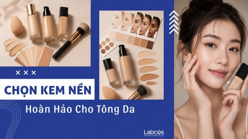 chon-kem-nen-hoan-hao-cho-tong-da