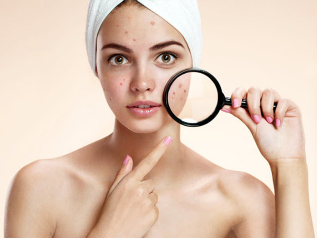 Gia công serum BHA điều trị mụn chuyên sâu
