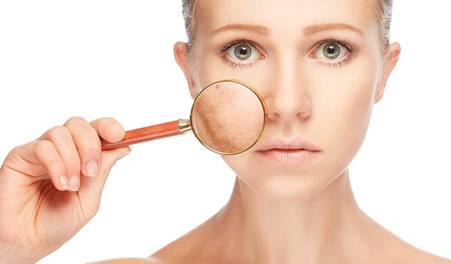 Giúp giảm vết thâm trên da, ngăn ngừa lão hóa