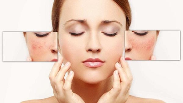 Những sai lầm cần tránh trong cách điều trị nám da