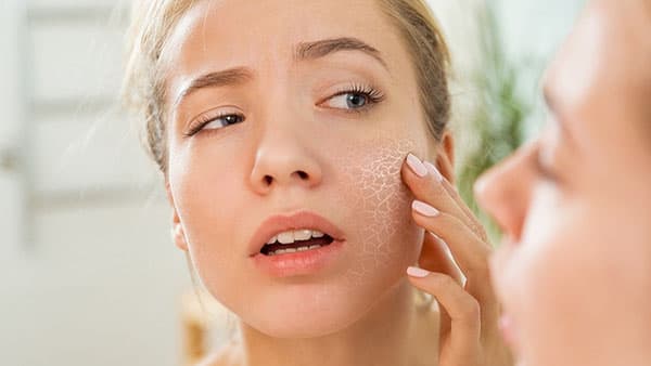 Sự khác nhau giữa da khô và da mất nước? Và cách khắc phục